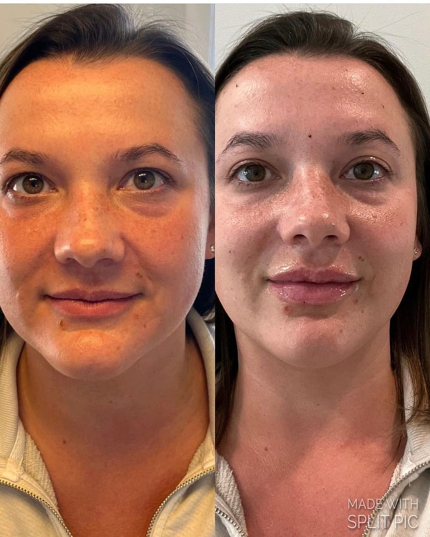 Preventing Aging: Habits and Medical Spa Tips